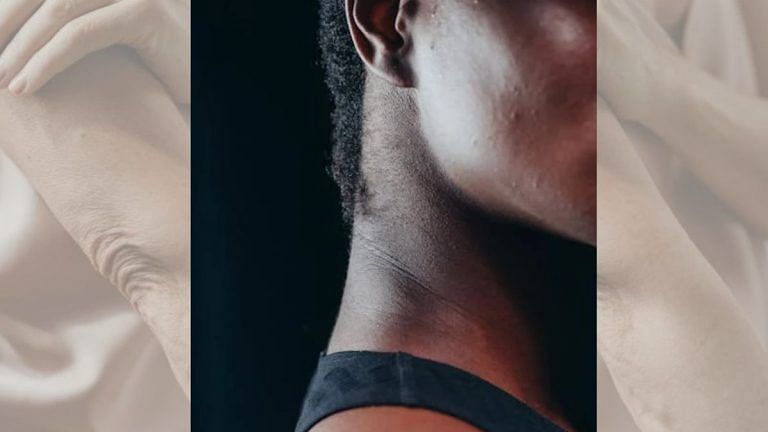 Dark patches on your neck & hands could signal diabetes. Visit a doctor, not the salon