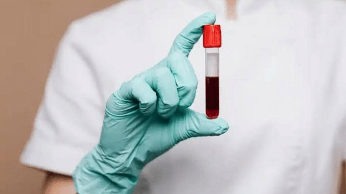 Image of a medical professional holding a blood sample