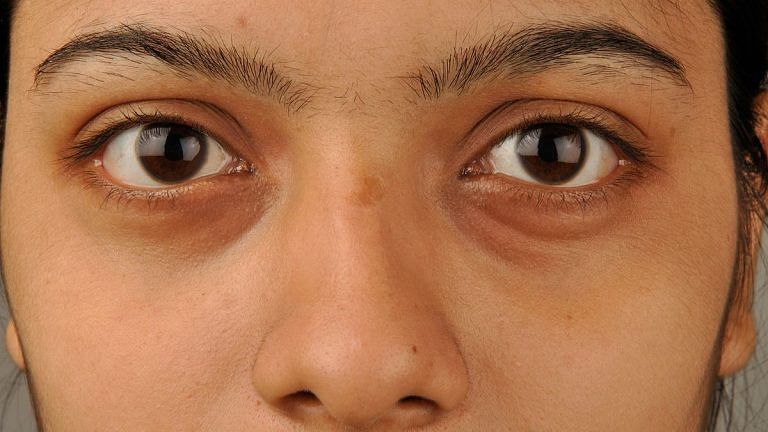 Tea bags alone can’t hold off post-party puffy eyes. You need a night routine