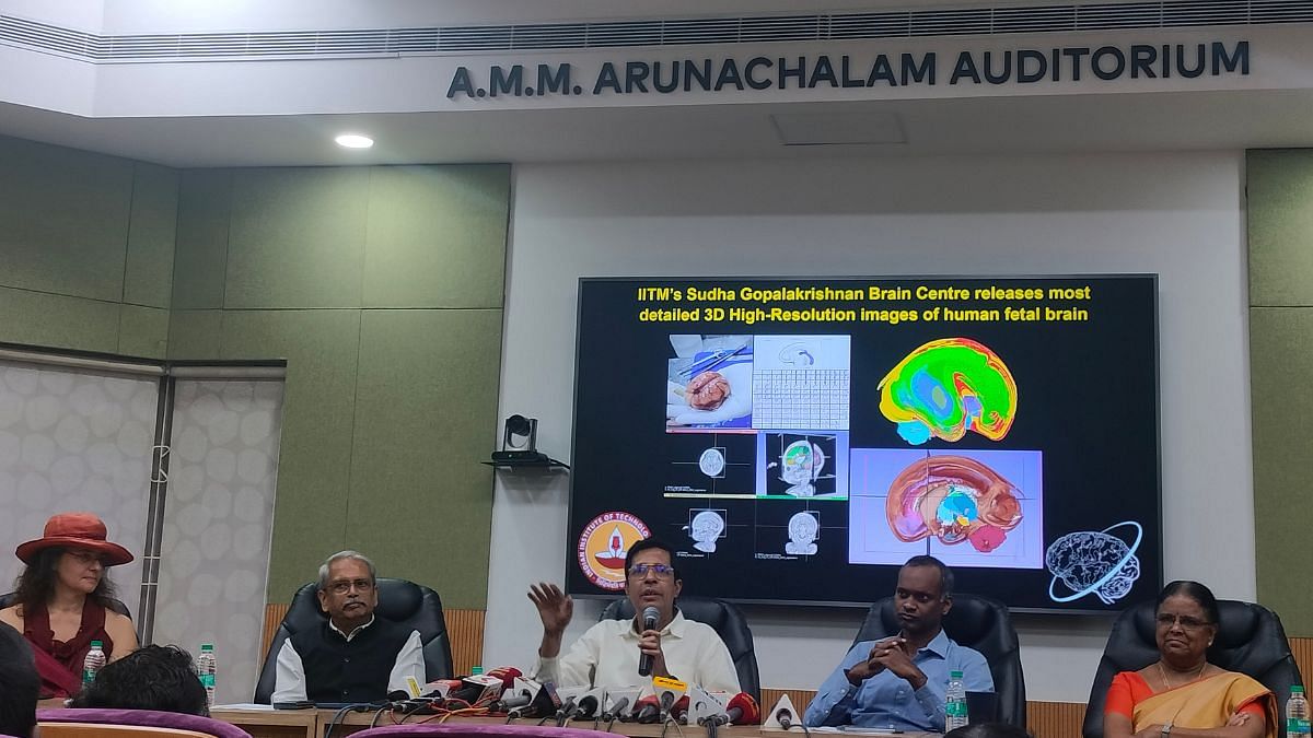 IIT Madras releases detailed 3D images of human foetal brain. Can help understand developmental disorders