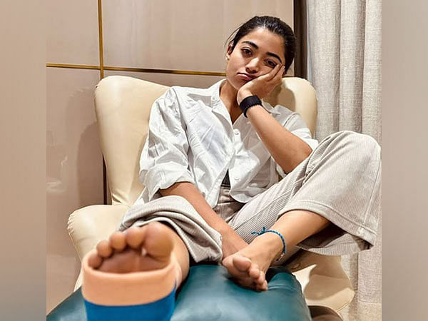 Rashmika Mandanna gets injured during gym session, shares her health update