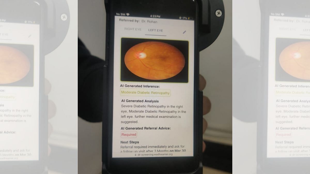 The diabetic retinopathy assessment AI app | Mrinalini Dhyani | ThePrint 