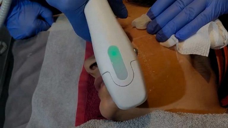I’ve seen HIFU transform skin and self-confidence. Know the risks and costs too