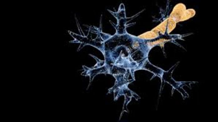 Guillain-Barré Syndrome causes nerves to get demyelinated | Representational image | Commons