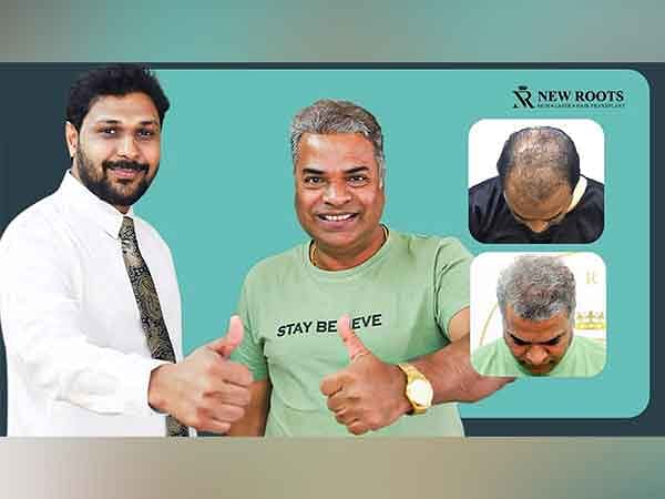 Actor Producer Bharat Jadhav Overcomes Failed Hair Treatment with the Help from New Roots