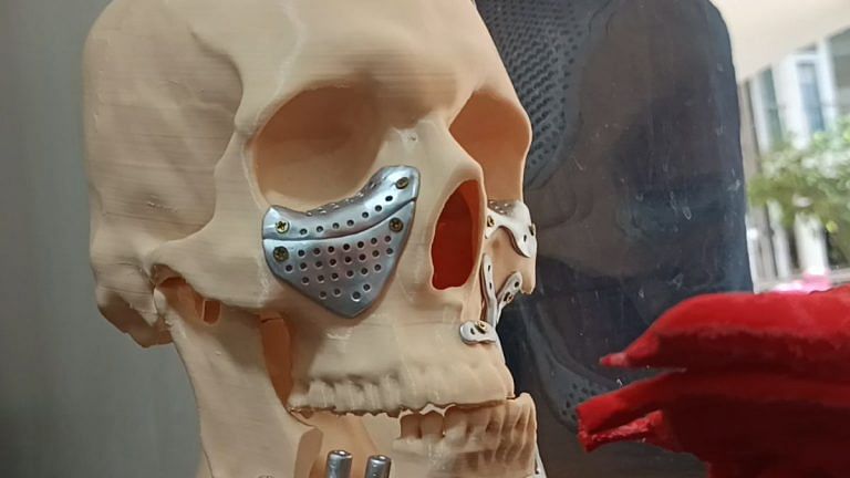 Bengaluru startups are 3D-printing human body parts. It’s sci-fi to surgery