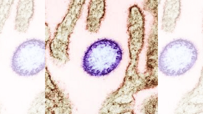 post-thumbnail