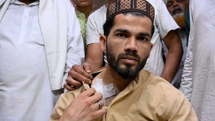 Saif Ali, the victim's cousin, was sweeping the floor of the restaurant when he heard the gunshot. As he stepped out, another bullet was fired. He ducked to take cover, and it grazed his shoulder. | Suraj Singh Bisht | ThePrint