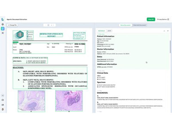 LandingAI utilizes FPT AI Factory to accelerate the Visual AI platform