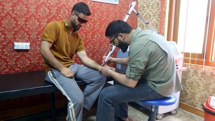 Tattoos in Kashmir. Removal in progress