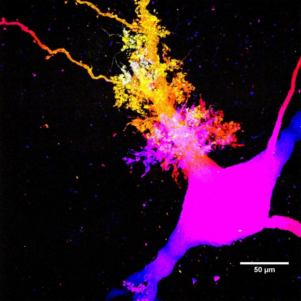 neuron