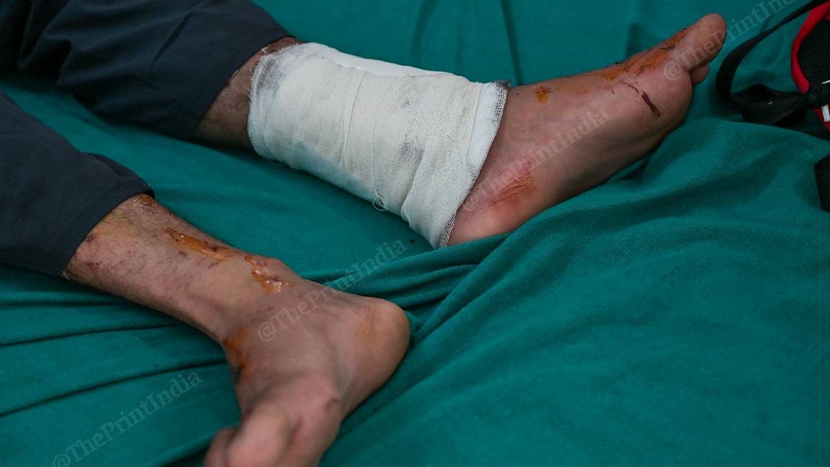 डॉक्टरों के मुताबिक, ज़्यादातर बाढ़ पीड़ितों को पैरों में चोट लगी है | फोटो: सूरज सिंह बिष्ट/दिप्रिंट