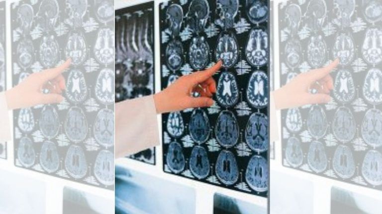 Harvard researchers may have found key piece to Alzheimer’s puzzle. It was in the human brain all along