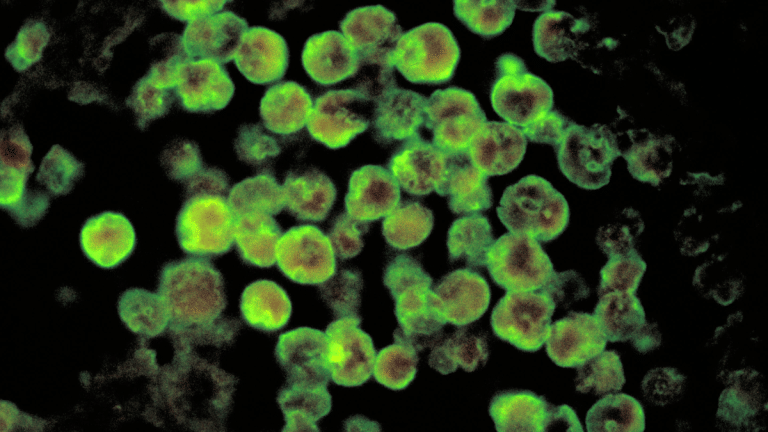 Rare ‘brain-eating’ amoebic infection resurfaces in Kerala, Kozhikode district on alert