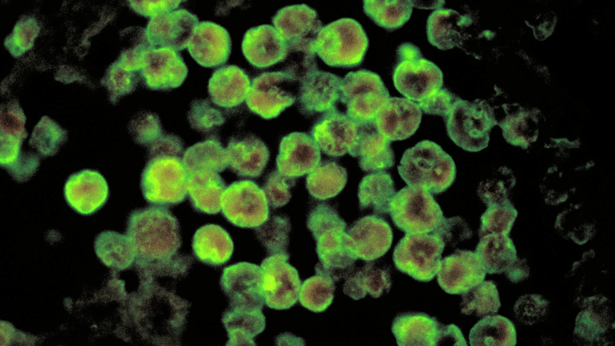 Rare ‘brain-eating’ amoebic infection resurfaces in Kerala, Kozhikode district on alert