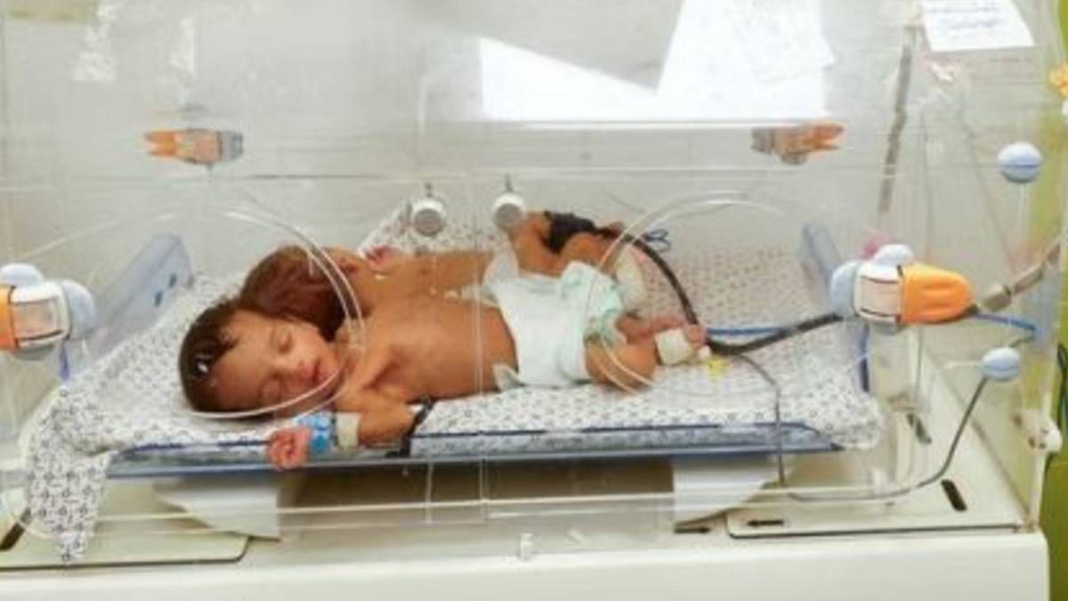 Pre-term birth leading cause of neonatal deaths in India. ICMR’s push to give preemies fighting chance