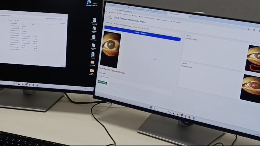 AI in eye care 