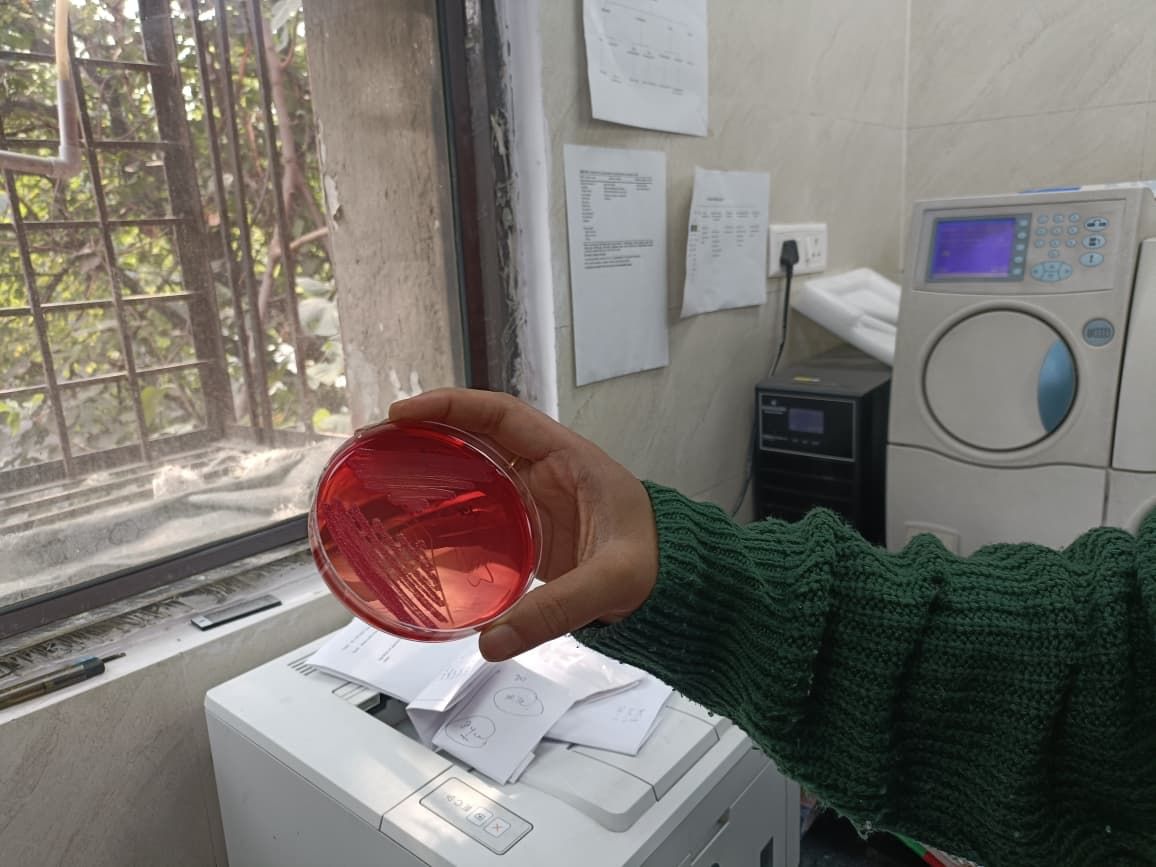 One of the researchers in the lab shows how bacteria are grown on the agar plate to be studied. | Akanksha Mishra | ThePrint