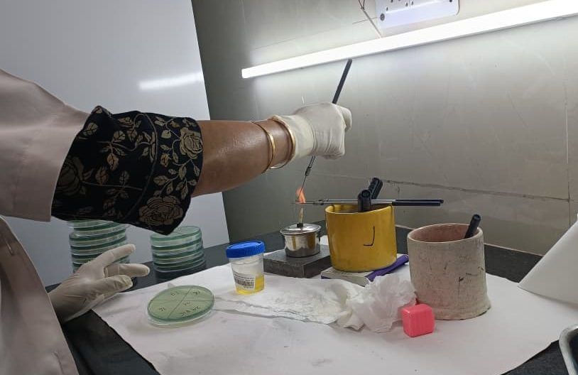 The microbiology lab receives 200-300 samples daily of urine, blood, and pus, as well as respiratory swabs from inpatient departments and ICUs. | Akanksha Mishra | ThePrint
